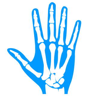 New Manchester study evaluates steps towards cost-effectiveness of implementing a personalised treatment approach for rheumatoid arthritis (RA) patients