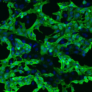 Manchester Regenerative Medicine (MaRM) Network Launch Event 23 May