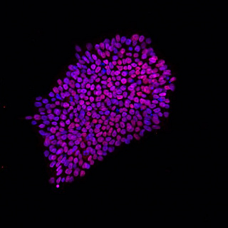 Dr Bailey awarded prestigious British Heart Foundation Fellowship to study a rare inherited heart rhythm condition