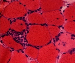 Manchester researchers provide new insight into rare musculoskeletal condition