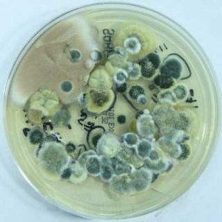 Mould discovery in lungs paves way for helping hard to treat asthma