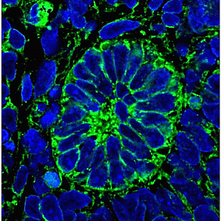 Scientists create functioning kidney tissue