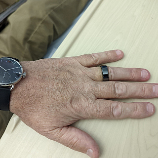 Trial of wearable health technology for cancer patients opens