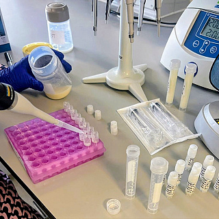 Researchers study breast milk as an early detection tool for breast cancer