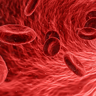 First in Europe to recruit patient to Sickle Cell Disease study