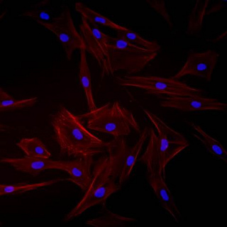 Disease caused by reduction of most abundant cellular protein identified