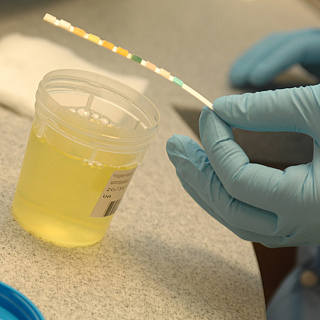 Simple urine test can detect womb cancer