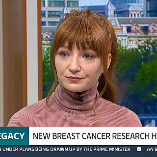 National coverage for pioneering breast cancer study at MFT