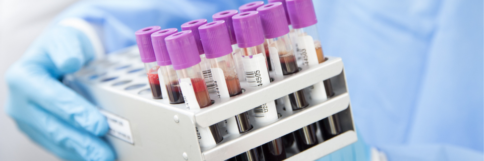 Blood test to detect cancer returning reaches final trial stage